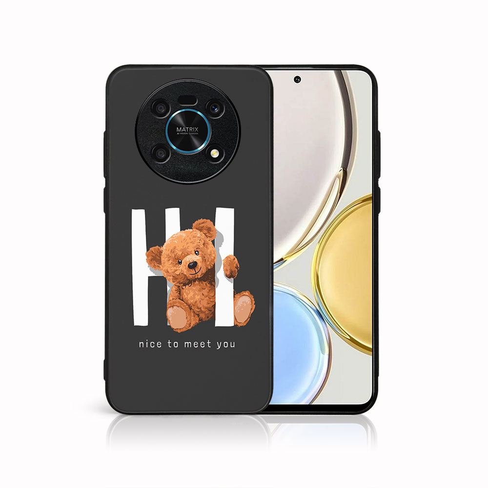 Levně MY ART Ochranný kryt pro Honor Magic4 Lite 5G HI (182)