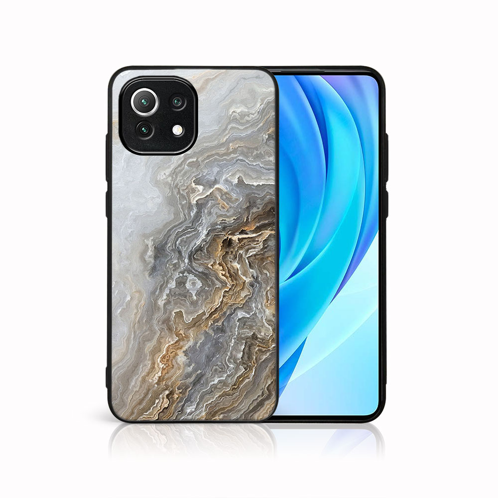 Levně MY ART Ochranný kryt Xiaomi Mi 11 Lite / 11 Lite 5G / 11 Lite NE 5G -BEIGE (151)